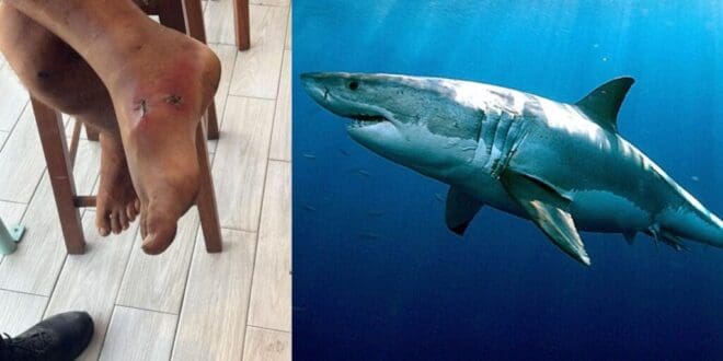 Descartan ataque de tiburón en Playa del Carmen; extranjero presentaba lesión previa por mordedura de algún tipo de fauna no identificada